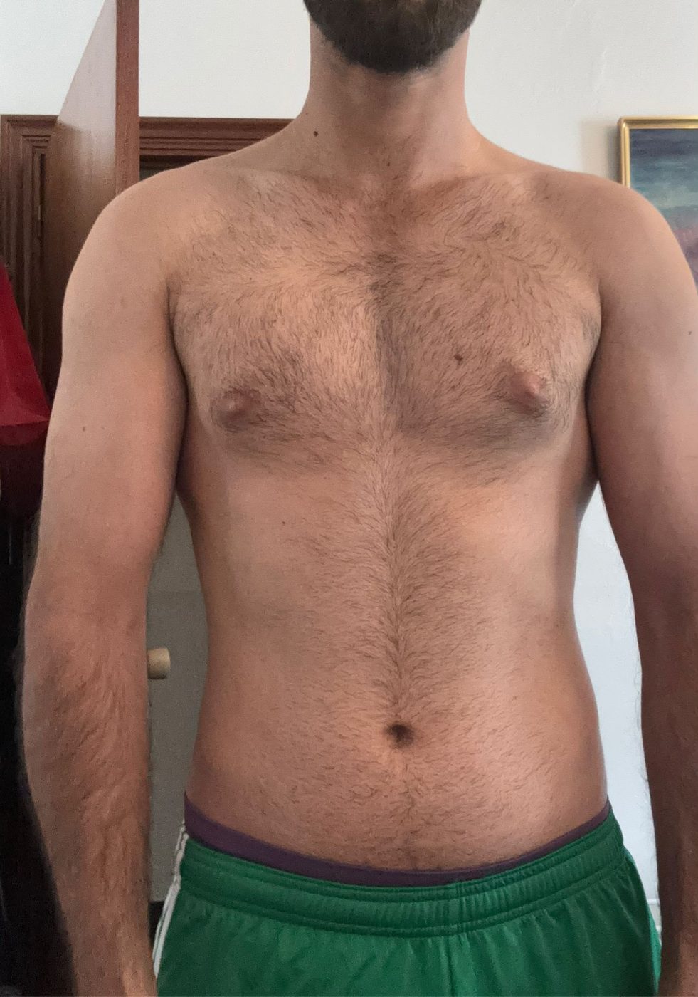 Tomás después
