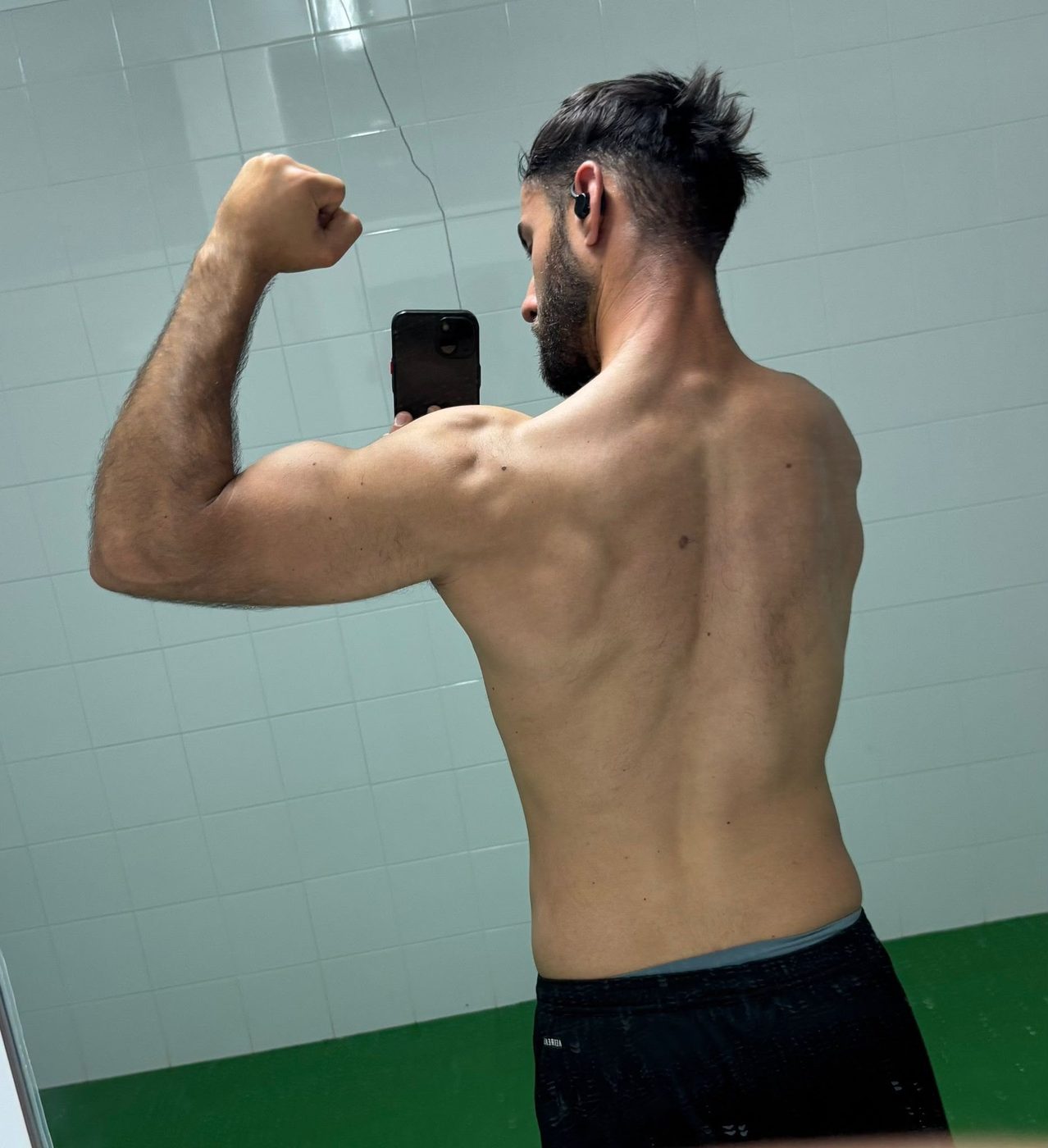 Tomás espalda después